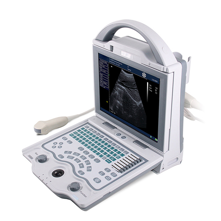 CFV5600V Portable Black White Vet Ultrasound Scanner - 图片 2
